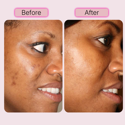 PDRN Pink Peptide Facial Serum