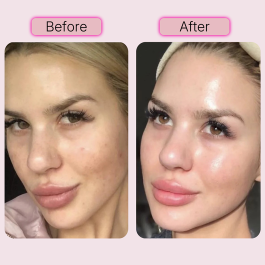 PDRN Pink Peptide Facial Serum