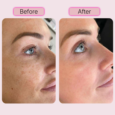PDRN Pink Peptide Facial Serum